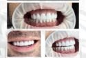 Design Your Smile - Hayk Arakelyan, DDS (10)