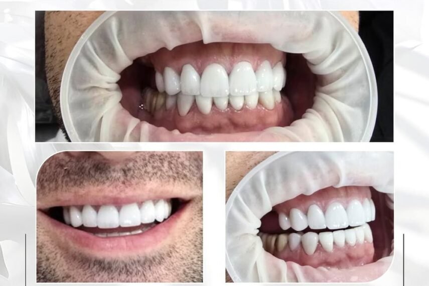 Design Your Smile - Hayk Arakelyan, DDS (10)