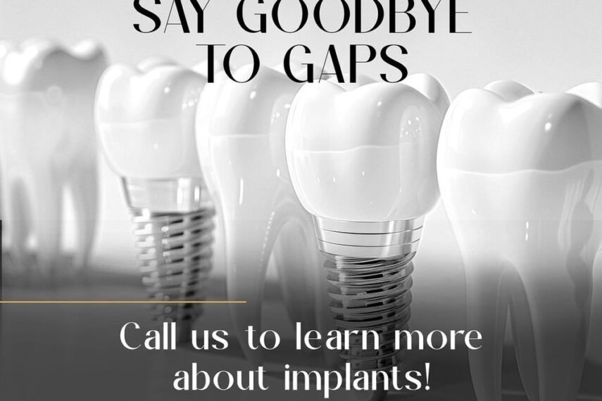 Design Your Smile - Hayk Arakelyan, DDS (14)